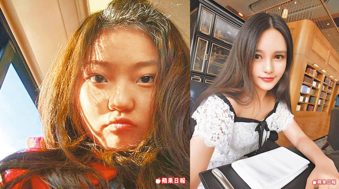 Grace Chow’s before and after plastic surgery photos. 